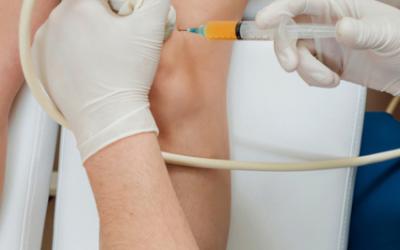 Kolano puchnie bez urazu – 7 scenariuszy i kiedy pilnie do lekarza